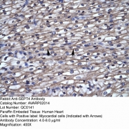 AVARP02014_P050 - Septin-4 (SEPT4)