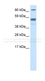 AVARP02014_P050 - Septin-4 (SEPT4)