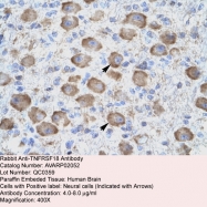 AVARP02052_P050 - TNFRSF18 / GITR