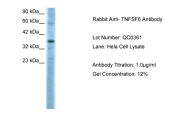 AVARP02054_T100 - CD178 / Fas Ligand