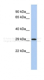 AVARP02058_P050 - 14-3-3 protein epsilon