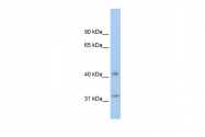 AVARP02062_P050 - 14-3-3 protein theta