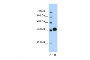 AVARP03005_T100 - CDK6