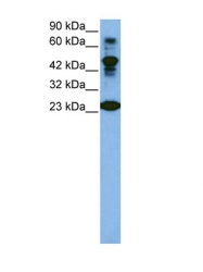 AVARP03006_T100 - CDK2
