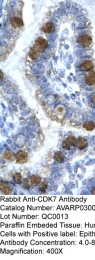 AVARP03009_T100 - CDK7