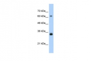 AVARP03018_T100 - PCNA