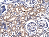 AVARP03024_P050 - CDK1
