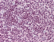 AVARP03031_P050 - CDC20