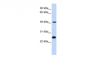 AVARP03034_P050 - CDC25C