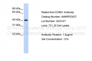 AVARP03037_P050 - Cyclin D1