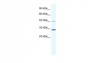 AVARP03038_P050 - Cyclin D3