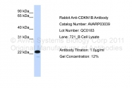 AVARP03039_P050 - CDKN1B / KIP1