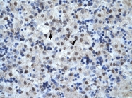AVARP06004_P050 - MAP kinase p38 alpha / MAPK14