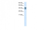 AVARP06004_P050 - MAP kinase p38 alpha / MAPK14