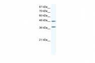 AVARP06004_T100 - MAP kinase p38 alpha / MAPK14