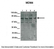 AVARP06007_P050 - MDM4