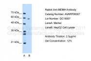 AVARP06007_T100 - MDM4