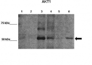 AVARP06008_P050 - AKT1 / PKB