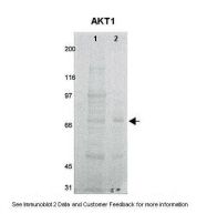 AVARP06008_P050 - AKT1 / PKB