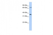 AVARP07017_P050 - CD194 / CCR4