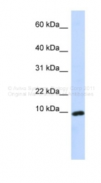 AVARP07022_P050 - CXCL9