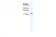 AVARP07023_P050 - CXCL14 / BRAK