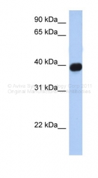 AVARP07030_P050 - CD186 / CXCR6