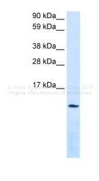 AVARP07031_P050 - CXCL12 / SDF1