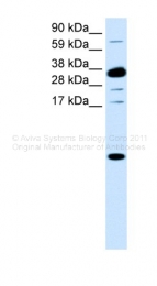 AVARP07032_P050 - CXCL1 / GRO-alpha