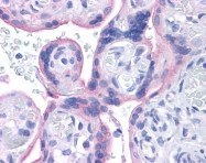 AVARP08005_P050 - CD220 / INSR