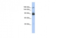 AVARP08005_P050 - CD220 / INSR