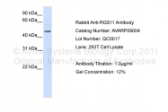AVARP09004_P050 - RGS11