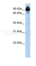 AVARP09007_P050 - RGS3