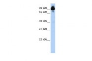 AVARP09007_T100 - RGS3