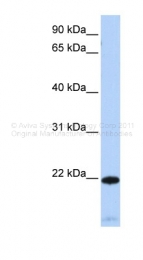 AVARP09015_P050 - RGS5