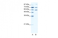 AVARP09016_T100 - HSP90AB1 / HSP90 beta