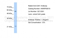 AVARP09019_T100 - Caveolin-1