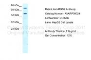 AVARP09024_T100 - RGS9
