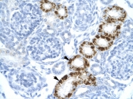 AVARP09033_P050 - EIF2AK2 / PKR