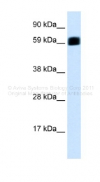AVARP09033_P050 - EIF2AK2 / PKR