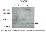 AVARP09044_P050 - NFKBIA / IKBA