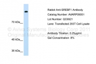 AVARP09051_P050 - SREBF1 / SREBP1