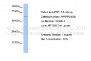 AVARP09056_P050 - PDE1B