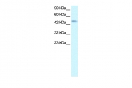 AVARP09059_T100 - CDw198 / CCR8
