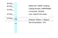 AVARP09060_T100 - HSPB1 / HSP27