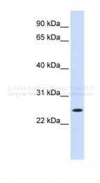 AVARP13001_P050 - NOL3 / ARC