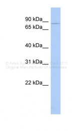 AVARP13011_P050 - CHM / REP1