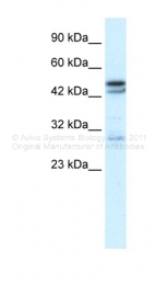 AVARP13014_P050 - Neuronal acetylcholine receptor subunit alpha-3