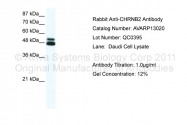 AVARP13020_P050 - Neuronal acetylcholine receptor subunit beta-2
