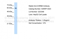 AVARP13023_T100 - Acetylcholine receptor epsilon